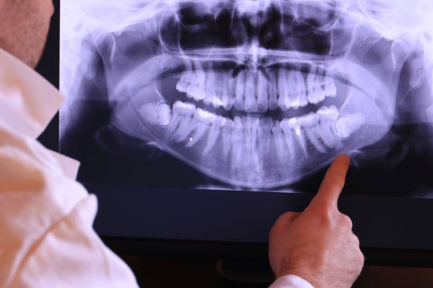 Best Emergency Treatment for Toothache in Kennewick, WA